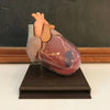 Small Heart Model