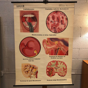 German Educational Anatomical Sepsis Study Chart