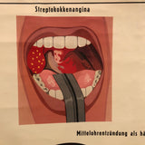 German Educational Anatomical Sepsis Study Chart