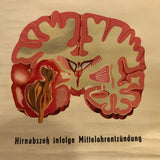German Educational Anatomical Sepsis Study Chart