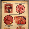 German Educational Anatomical Sepsis Study Chart