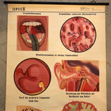 German Educational Anatomical Sepsis Study Chart