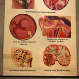 German Educational Anatomical Sepsis Study Chart