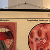 German Educational Anatomical Sepsis Study Chart