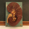 Kidney Model on Plaque