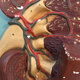 Kidney Model on Plaque
